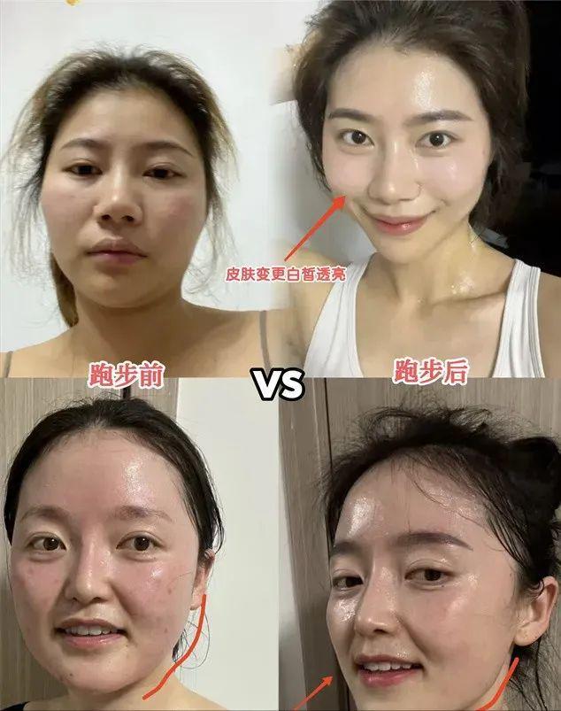 坚持跑步等于“整容”！看看这些素人运动前后的对比你就知道了(图4)