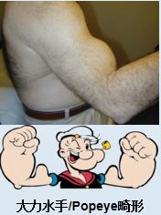 省内首例！济南市三院运动医学科治疗肩袖撕裂(图2)