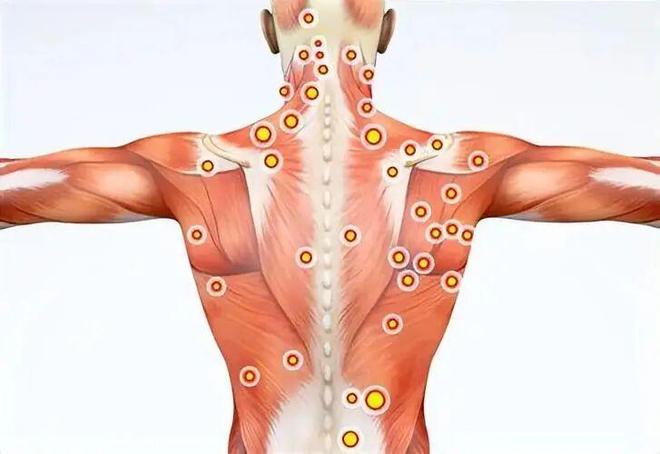 运动后疼痛是“有效”还是“受伤”？(图4)