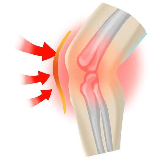 运动后疼痛是“有效”还是“受伤”？(图7)